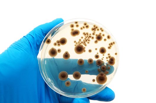 microorganisms on the agar plate