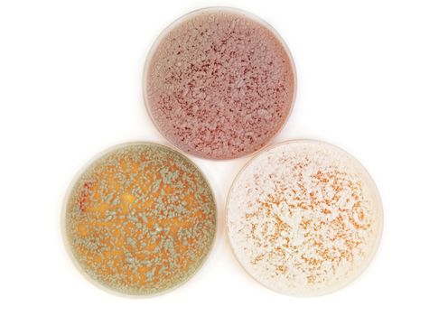 different fungi microorganisms on agar plate