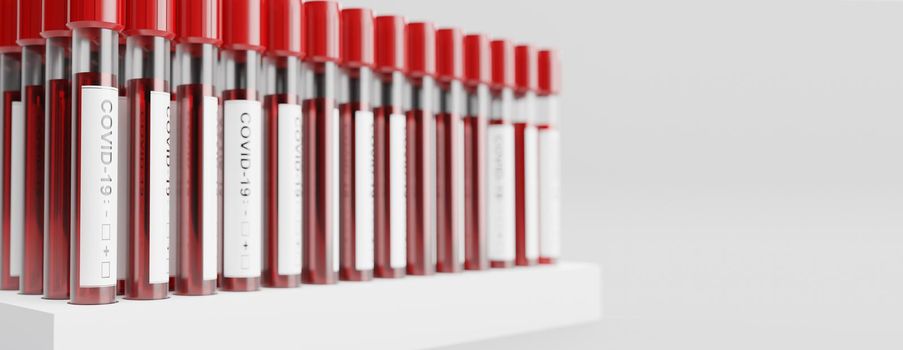 Coronavirus 2019-nCoV Blood Sample. 3D Rendering