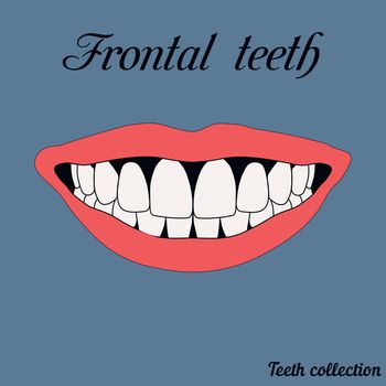 Frontal teeth