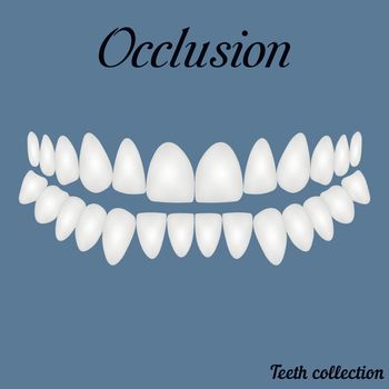 occlusion