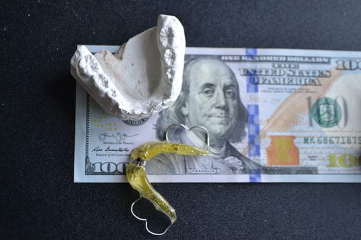 Plaster cast of teeth and dental plate on the background of money