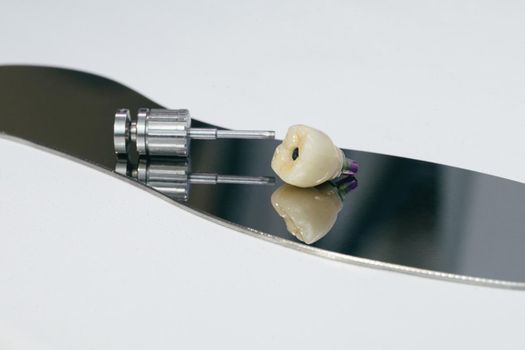 Monolithic screw retained zirconium crown on the implant, a screw and a manual key for screwing the crown