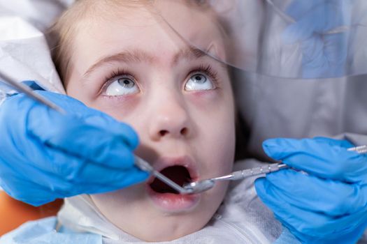 Close up of kid getting caries treatment from dentist