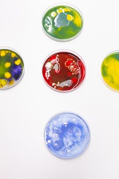 Mixed of bacteria colony in petri dish standing on table in biological scientific hospital laboratory.