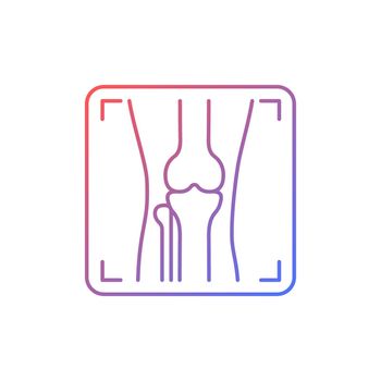 Arthritis x ray gradient linear vector icon