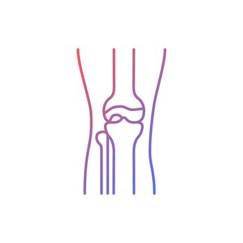 Osteoarthritis gradient linear vector icon