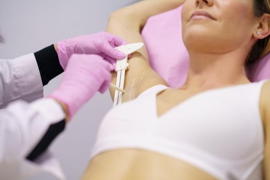 Doctor painting on the armpit of her patient, the area to be treated for hyperhidrosis.
