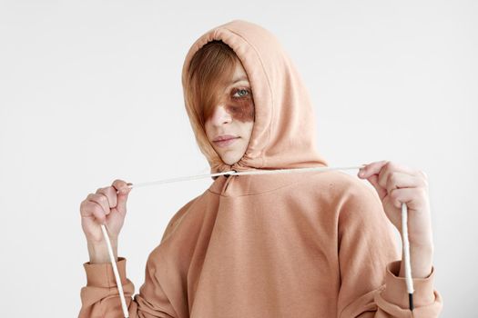 Woman with dark spot on face in hoodie