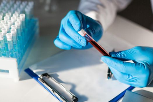 A test tube with blood in the hands of the researcher against the background of a table with test tubes and a clipboard with a description of immunological studies.