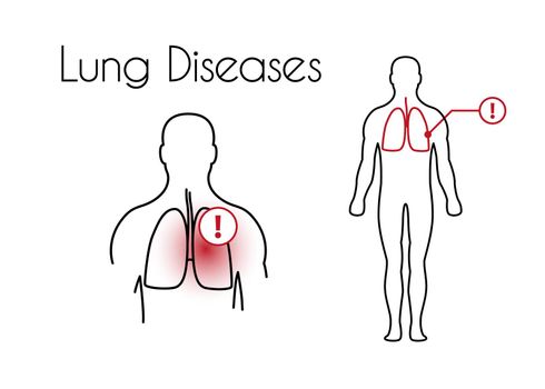 Vector Lung Diseases Linear Icon of Young Man