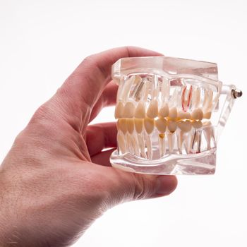 Dentist holding dentures jaw layout on a white background