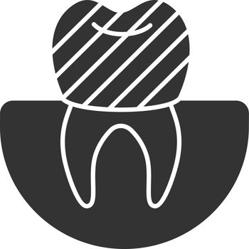 Dental crown glyph icon. Tooth restoration. Silhouette symbol. Negative space. Vector isolated illustration