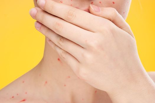 female face closeup red dots dermatology rash