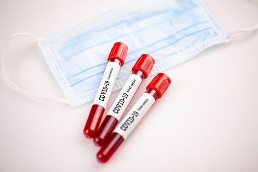 Blood sample for coronavirus