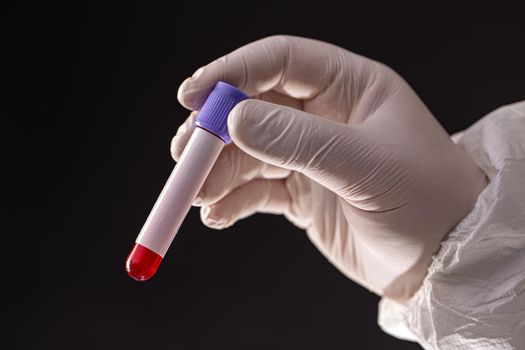 Male doctor's hands with blood sample