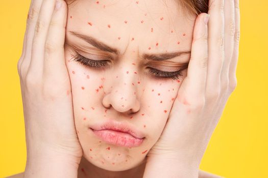 woman with red dots on her face skin problems dermatology dissatisfaction