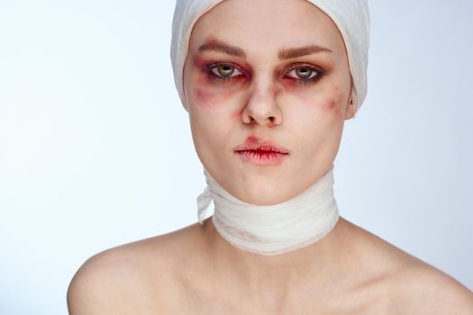 female patient facial injury health problems bruises pain studio lifestyle