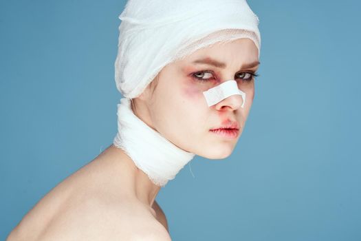 female patient bandaged face bruises bare shoulders discontent blue background
