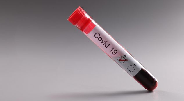 Positive test for covid in vitro closeup