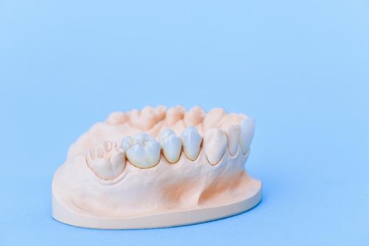 Gypsum model of human jaw