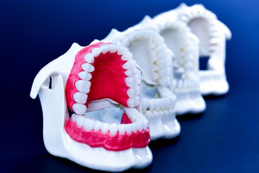 Dentist orthodontic teeth models