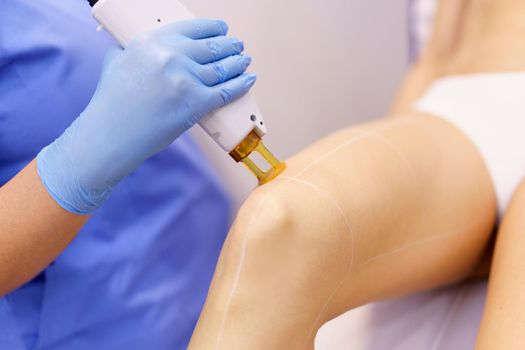 Woman receiving legs laser hair removal at a beauty center.