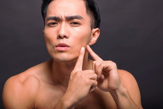 Handsome young man touching his face. Squeezing pimple.