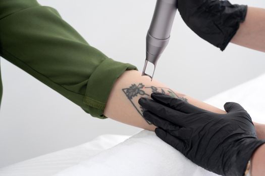 Beautician using laser device to remove an unwanted tattoo from female arm. Concept of erasing tattoos as an expensive procedure in a cosmetology clinic