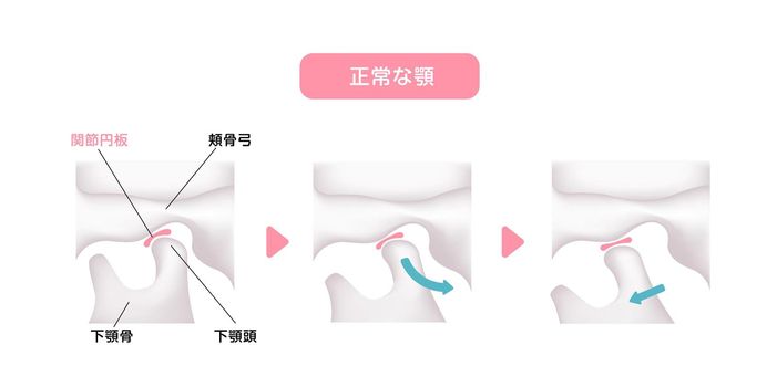 Structural illustration when opening and closing the jaw