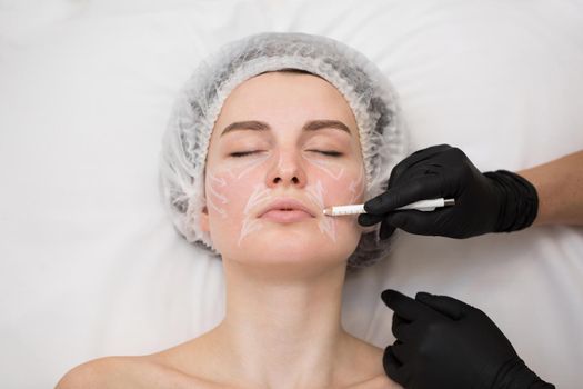 Beautician draws the contours of a white pencil on the face of the patient. Schematic marking before contouring. Close-up preparation of the face for cosmetic plastic surgery.