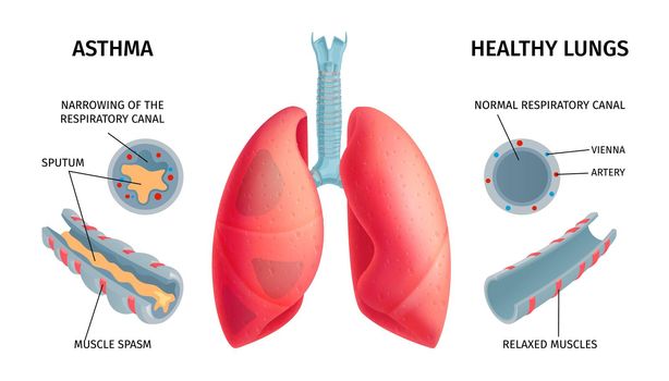 Human Lung Anatomy Infochart