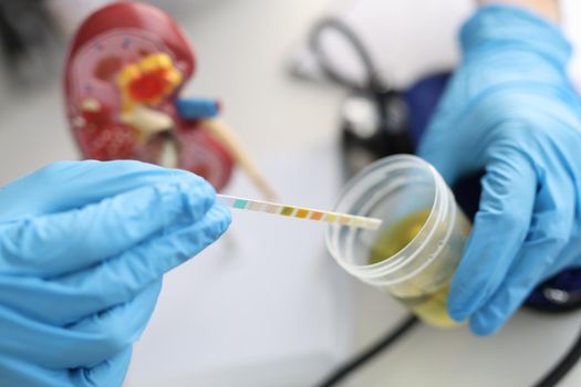 Doctor urologist making express urine test using indicator paper closeup
