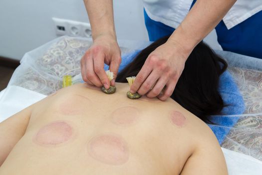 A woman taking a treatment of alternative medicine. Moxo therapy procedure.