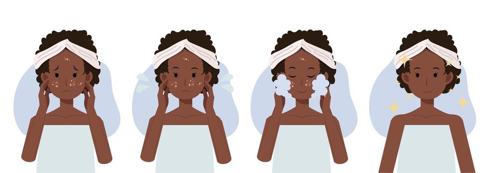 skin care concept, facial cleansing foam,acne treatment before and after,African american woman.flat vector cartoon illustration