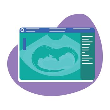 Fetal ultrasound 2D vector isolated illustration