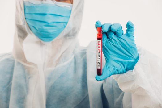 Medical scientist in PPE uniform wear a mask holding test tube Coronavirus