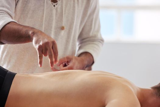 Im so glad I tried this. Shot of a acupuncturist treating a client.