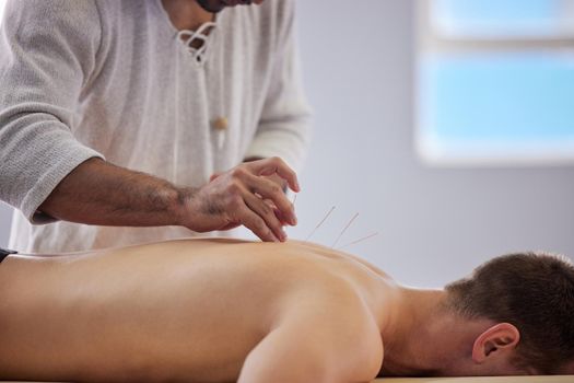Ive never felt more relaxed. Shot of a acupuncturist treating a client.