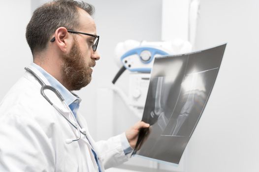 Doctor examine a film x-ray of a patient at radiology room.