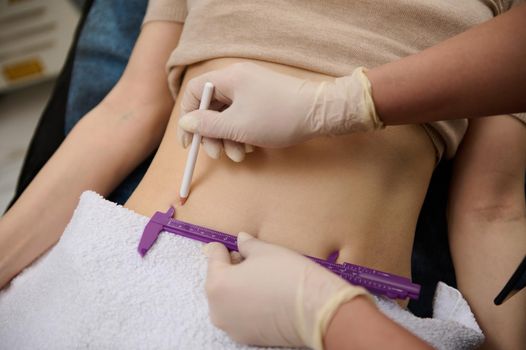 Close-up cosmetologist measures the level of belly fat with caliper and draws lines with white pencil on the woman's abdomen