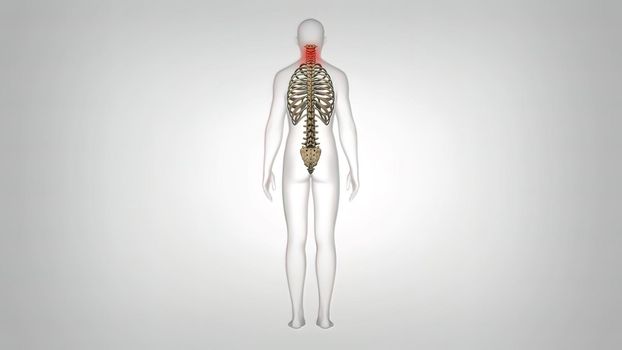 Skeletal representation of back and neck pain in human anatomy