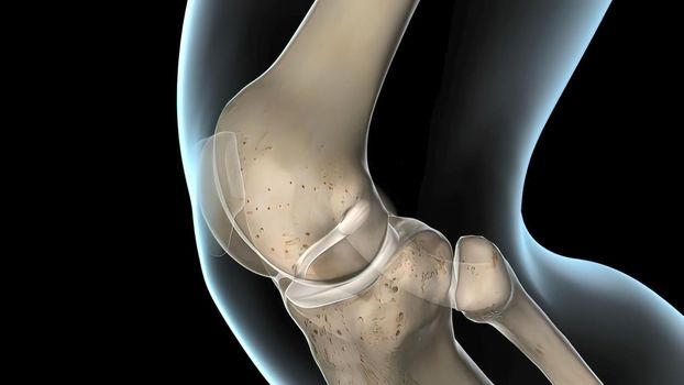 anterior cruciate ligament, the knee joint