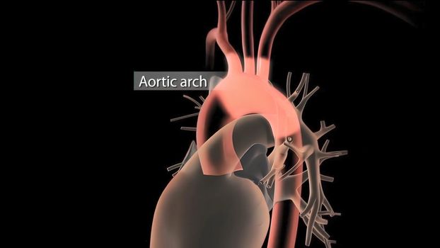 It may affect the left ventricle, aorta, aortic valve, or mitral valve.