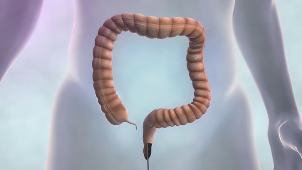 Colonoscopy is the visualization of the large intestine with a tube called a colonoscope.