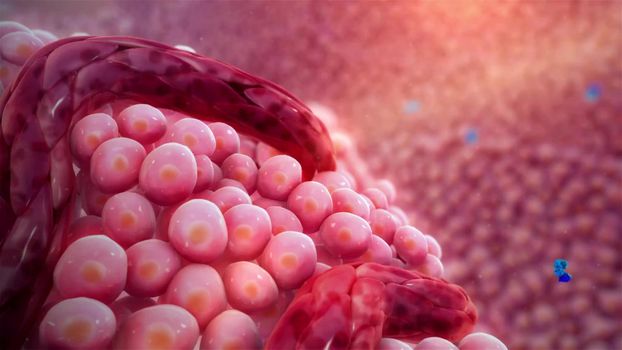 3D illustration Activated Cancer Cells, Growing Tumors