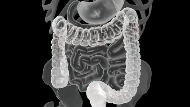 Colonoscopy Biopsy Of The Gastrointestinal Tract In Patients