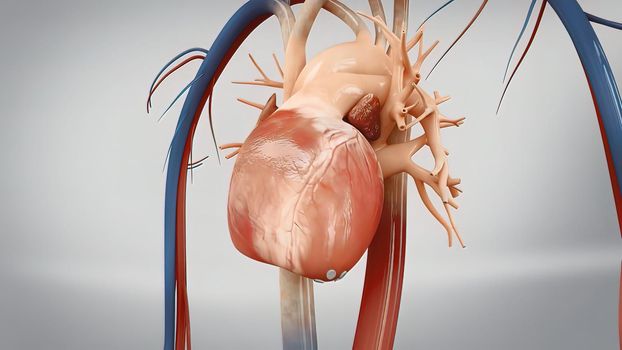 Coronary reimplantation in ascending aortic aneurysm
