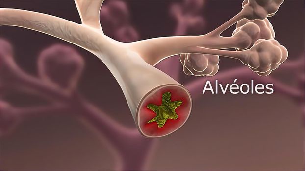 3D Medical illustration Respiratory System, Alveoli