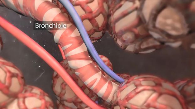 The bronchi are extensions of the windpipe that carries air to the lungs
